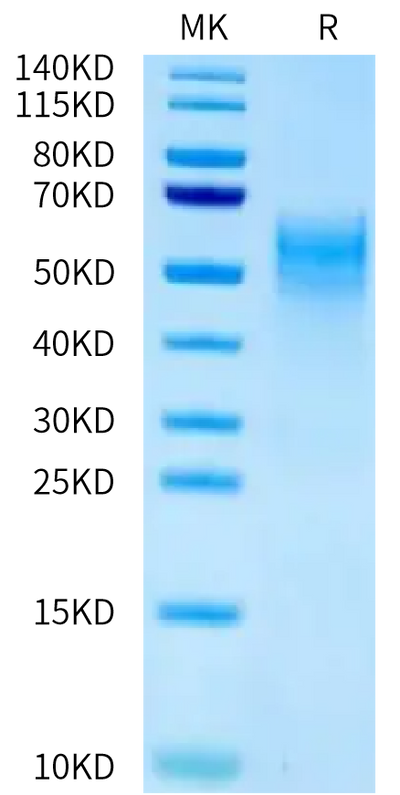 Mouse B7-H4 on Tris-Bis PAGE under reduced condition. The purity is greater than 95%.Recombinant Mouse B7-H4 Protein