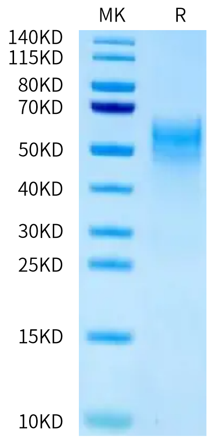 Mouse B7-H4 on Tris-Bis PAGE under reduced condition. The purity is greater than 95%.Recombinant Mouse B7-H4 Protein
