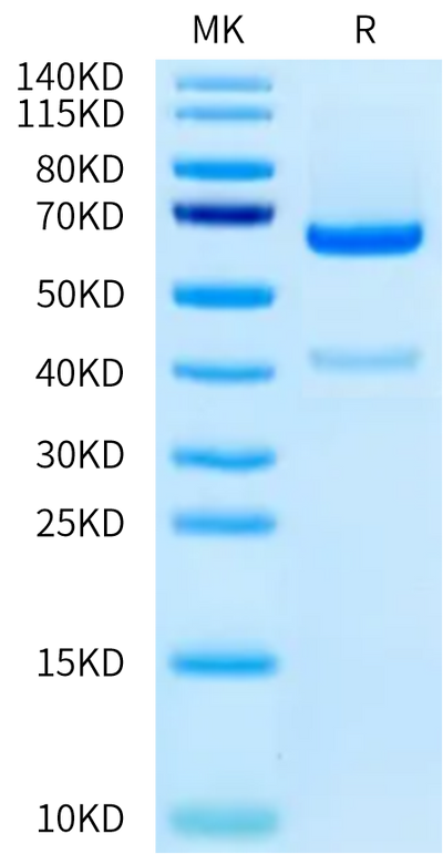 Human ADAM9 on Tris-Bis PAGE under reduced condition. The purity is greater than 90%.Recombinant Human ADAM9 Protein
