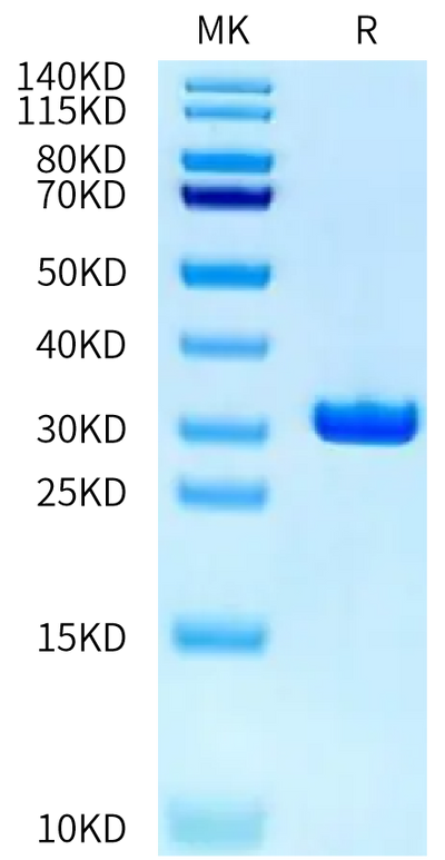 Human CA2 on Tris-Bis PAGE under reduced condition. The purity is greater than 95%.Recombinant Human CA2/Carbonic anhydrase II Protein
