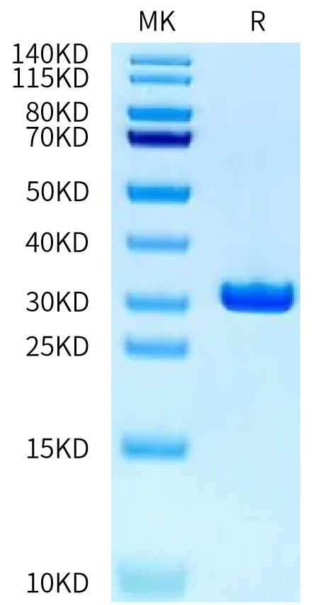 Human CA2 on Tris-Bis PAGE under reduced condition. The purity is greater than 95%.Recombinant Human CA2/Carbonic anhydrase II Protein