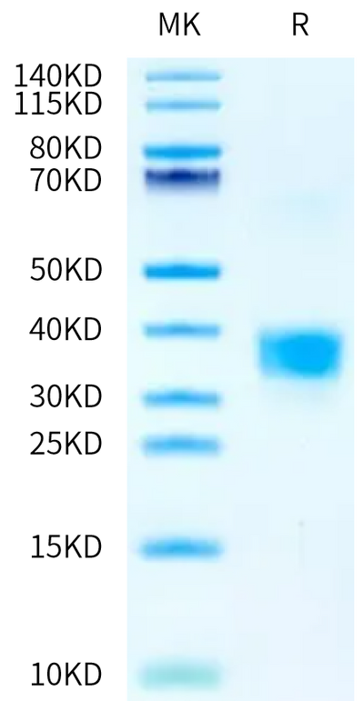 Rat TNFSF15 on Bis-Tris PAGE under reduced condition. The purity is greater than 95%.Recombinant Rat TNFSF15 Protein, Active