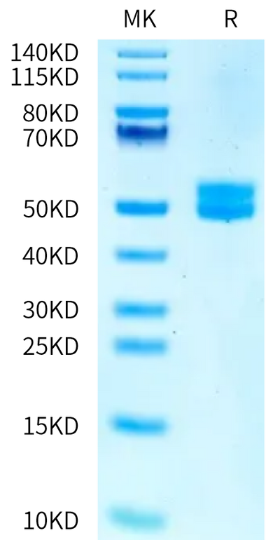 Human MSLN on Tris-Bis PAGE under reduced condition. The purity is greater than 95%.