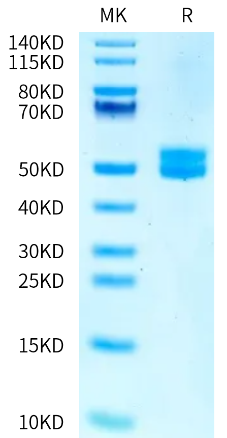 Human MSLN on Tris-Bis PAGE under reduced condition. The purity is greater than 95%.Recombinant Human MSLN/Mesothelin Protein, Active