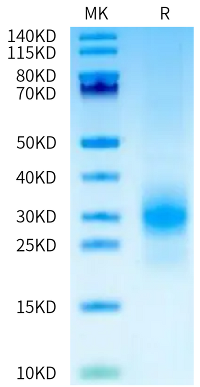 Human MSLN on Tris-Bis PAGE under reduced condition. The purity is greater than 95%.Recombinant Human MSLN/Mesothelin Protein, Active