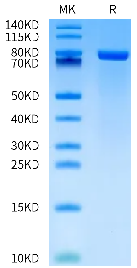 FITC-Labeled Human Transferrin on Bis-Tris PAGE under reduced condition. The purity is greater than 95%.Recombinant FITC-Labeled Human Transferrin Protein, Active