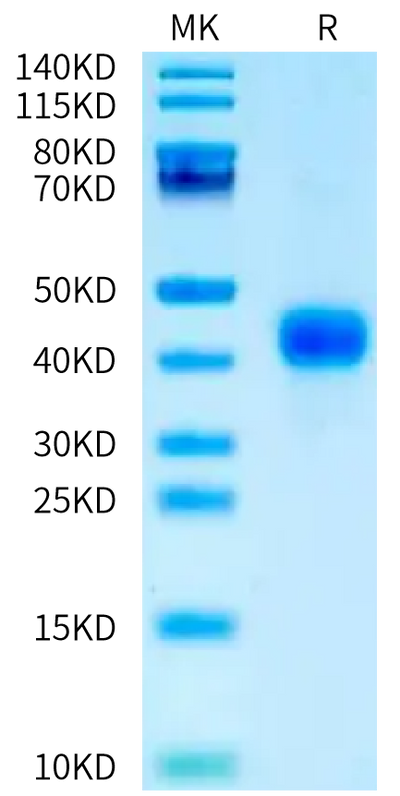 Mouse CD27 on Tris-Bis PAGE under reduced condition. The purity is greater than 95%.Recombinant Mouse CD27/TNFRSF7 Protein, Active