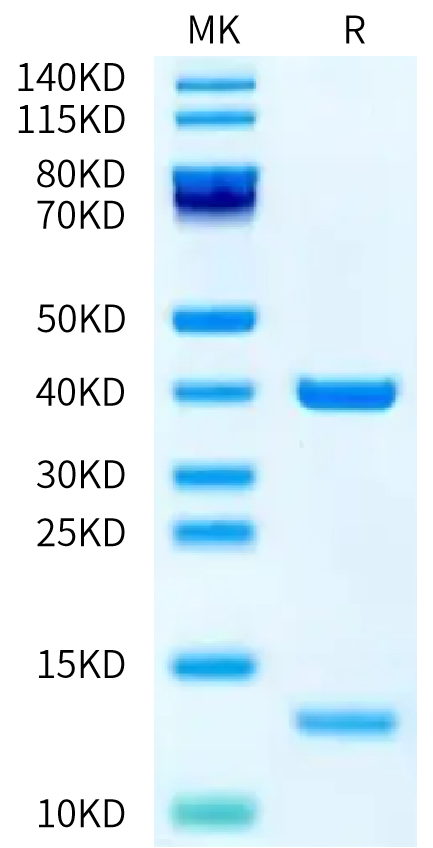 Biotinylated Human HLA-A*02:01&B2M&P53 R175H (HMTEVVRHC) Monomer on Tris-Bis PAGE under reduced condition. The purity is greater than 95%.Biotinylated Human HLA-A*02:01&B2M&P53 R175H (HMTEVVRHC) Monomer Protein, Active