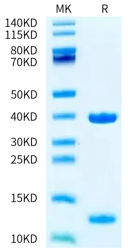 Biotinylated Human HLA-A*02:01&B2M&P53 WT (HMTEVVRRC) Monomer on Tris-Bis PAGE under reduced condition. The purity is greater than 95%.Biotinylated Human HLA-A*02:01&B2M&P53 WT (HMTEVVRRC) Monomer Protein
