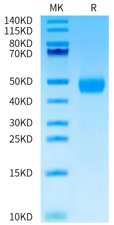 Human MASP3 on Bis-Tris PAGE under reduced condition. The purity is greater than 95%.Recombinant Human MASP3 Protein, Active