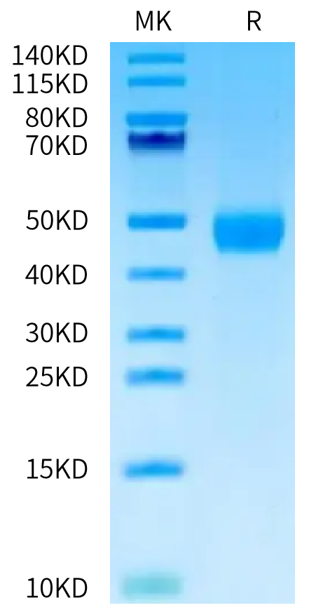 Human MASP3 on Bis-Tris PAGE under reduced condition. The purity is greater than 95%.Recombinant Human MASP3 Protein, Active