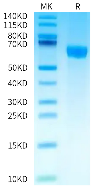 Human CD229 on Bis-Tris PAGE under reduced condition. The purity is greater than 95%.Recombinant Human CD229/SLAMF3 Protein
