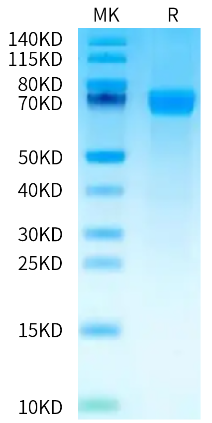 Human CD39 on Bis-Tris PAGE under reduced condition. The purity is greater than 95%.Recombinant Human CD39/ENTPD1 Protein, Active