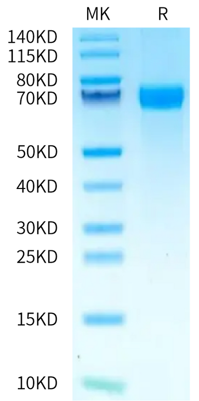 Human PD-L2 on Bis-Tris PAGE under reduced condition. The purity is greater than 95%.Recombinant Human PD-L2/B7-DC Protein, Active
