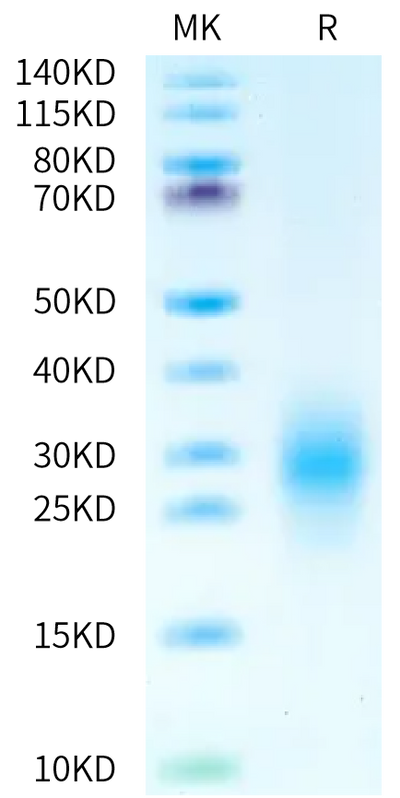 Human CD3G on Bis-Tris PAGE under reduced condition. The purity is greater than 95%.Recombinant Human CD3G/CD3 gamma Protein