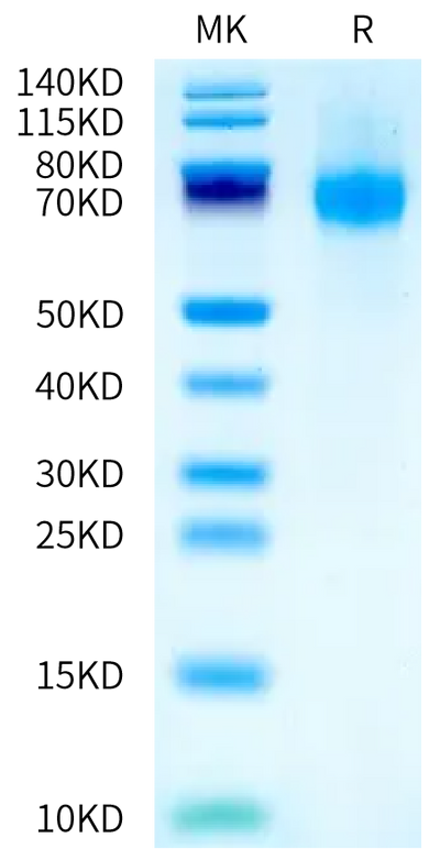 Biotinylated Mouse IFN alpha/beta R1 on Bis-Tris PAGE under reduced condition. The purity is greater than 95%.Biotinylated Mouse IFN alpha/beta R1 Protein, Active