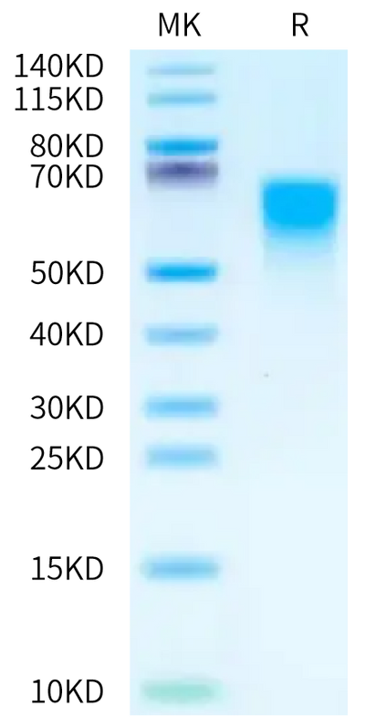 Cynomolgus CD55 on Tris-Bis PAGE under reduced condition. The purity is greater than 95%.Recombinant Cynomolgus CD55 Protein, Active