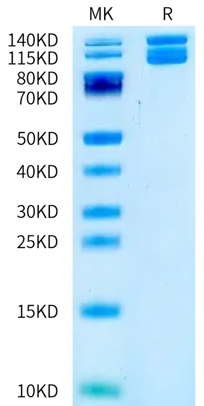 Mouse&Human Chimeric ITGAV&ITGB6 on Bis-Tris PAGE under reduced condition. The purity is greater than 95%.Recombinant Mouse&Human Chimeric Integrin alpha V beta 6 (ITGAV&ITGB6) Heterodimer Protein, Endotoxin-Free, Active