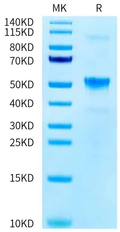 Mouse KLRG1 on Tris-Bis PAGE under reduced condition. The purity is greater than 95%.Recombinant Mouse KLRG1 Protein