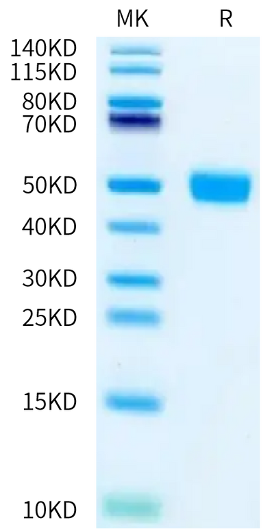 Rat MSLN on Bis-Tris PAGE under reduced condition. The purity is greater than 95%.Recombinant Rat MSLN/Mesothelin Protein, Active