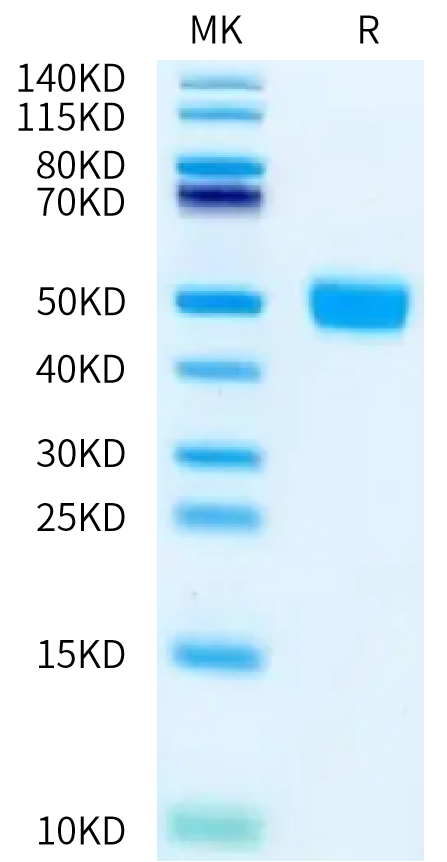 Rat MSLN on Bis-Tris PAGE under reduced condition. The purity is greater than 95%.Recombinant Rat MSLN/Mesothelin Protein, Active