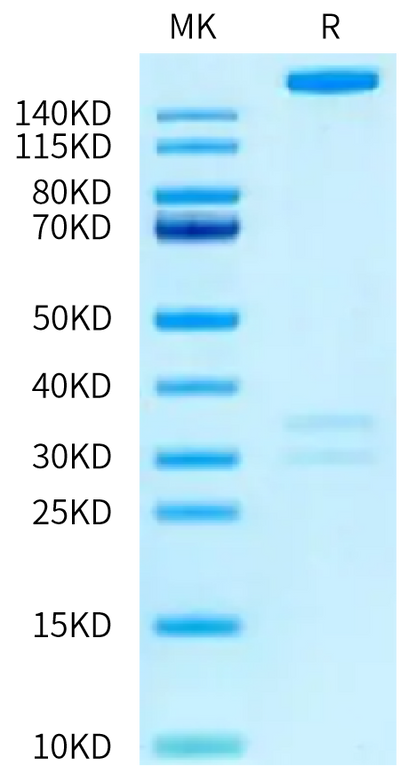 Human THSD7A on Tris-Bis PAGE under reduced condition. The purity is greater than 95%.Recombinant Human THSD7A Protein