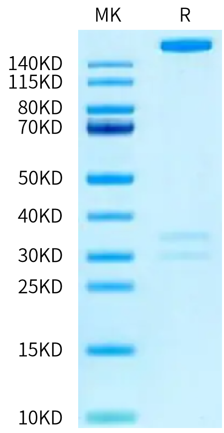 Human THSD7A on Tris-Bis PAGE under reduced condition. The purity is greater than 95%.Recombinant Human THSD7A Protein