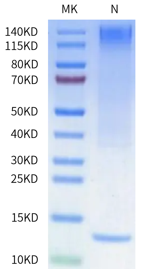 Human HLA-A*02:01&B2M&NY-ESO-1 (SLLMWITQC) Tetramer on Tris-Bis PAGE under Non reducing (N) condition. The purity is greater than 95%.Recombinant Human HLA-A*02:01&B2M&NY-ESO-1 (SLLMWITQC) Tetramer Protein, Active