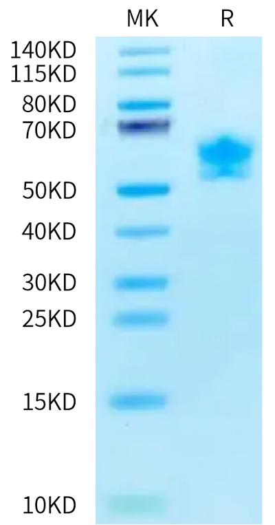 Human/Cynomolgus Activin RIIB on Bis-Tris PAGE under reduced condition. The purity is greater than 95%.Recombinant Human/Cynomolgus Activin RIIB/ACVR2B Protein, Active