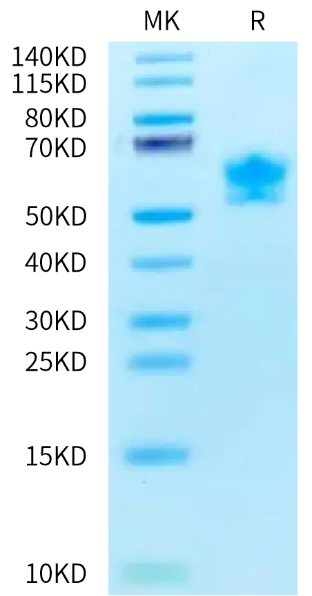 Human/Cynomolgus Activin RIIB on Bis-Tris PAGE under reduced condition. The purity is greater than 95%.Recombinant Human/Cynomolgus Activin RIIB/ACVR2B Protein, Active