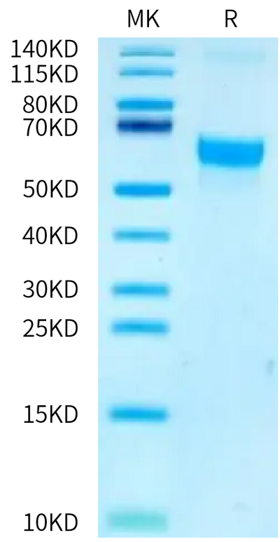 Biotinylated Human/Cynomolgus Activin RIIA on Bis-Tris PAGE under reduced condition. The purity is greater than 95%.Biotinylated Human/Cynomolgus Activin RIIA/ACVR2A-Protein, Active