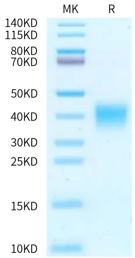 Mouse Activin RIIA on Bis-Tris PAGE under reduced condition. The purity is greater than 95%.Recombinant Mouse Activin RIIA/ACVR2A Protein, Active