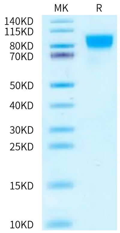 Biotinylated Cynomolgus IFN alpha/beta R1 on Bis-Tris PAGE under reduced condition. The purity is greater than 95%.Biotinylated Cynomolgus IFN alpha/beta R1 Protein, Active