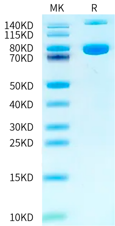 Mouse Transferrin R on Tris-Bis PAGE under reduced condition. The purity is greater than 95%.Recombinant Mouse Transferrin R/CD71 Protein