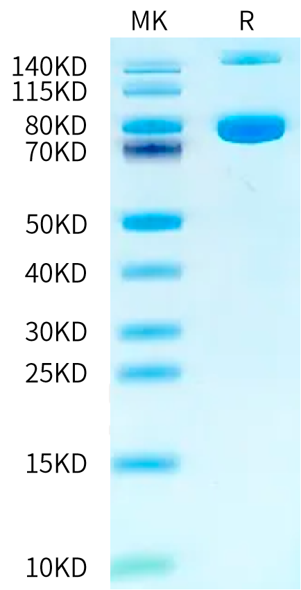 Mouse Transferrin R on Tris-Bis PAGE under reduced condition. The purity is greater than 95%.Recombinant Mouse Transferrin R/CD71 Protein