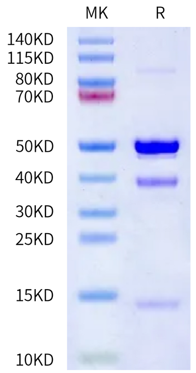 Human Latent GDF-8 on Bis-Tris PAGE under reduced condition. The purity is greater than 95%.Recombinant Human Latent GDF-8 Protein, Active