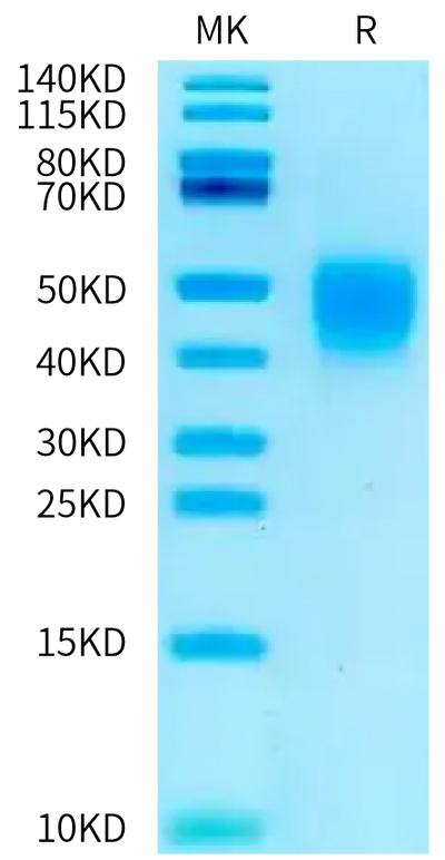 Rat CD28 on Tris-Bis PAGE under reduced condition. The purity is greater than 95%.