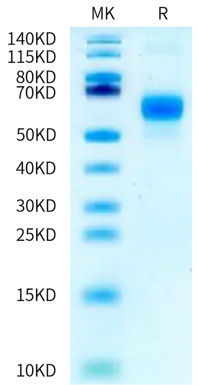 Human/Cynomolgus Activin RIIA on Bis-Tris PAGE under reduced condition. The purity is greater than 95%.Recombinant Human/Cynomolgus Activin RIIA/ACVR2A-Protein, Active