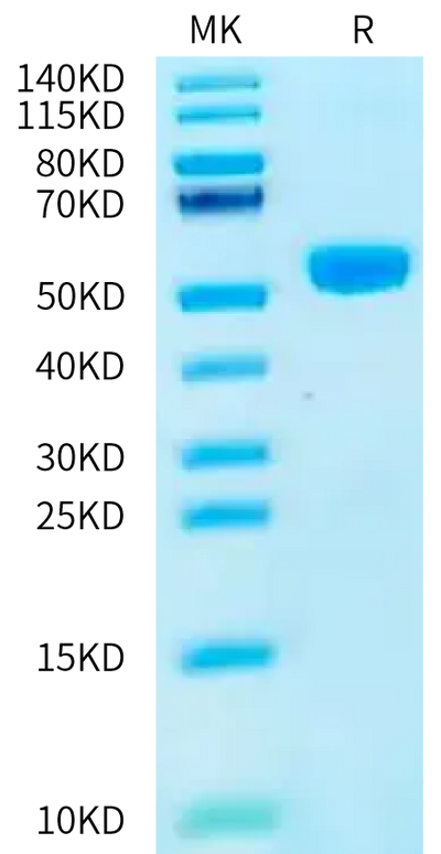 Human GIPR on Bis-Tris PAGE under reduced condition. The purity is greater than 95%.Recombinant Human GIPR Protein, Active