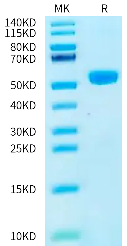 Human GIPR on Bis-Tris PAGE under reduced condition. The purity is greater than 95%.Recombinant Human GIPR Protein, Active