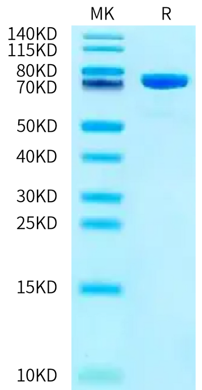 Mouse DPP3 on Bis-Tris PAGE under reduced condition. The purity is greater than 95%.Recombinant Mouse DPP3 Protein