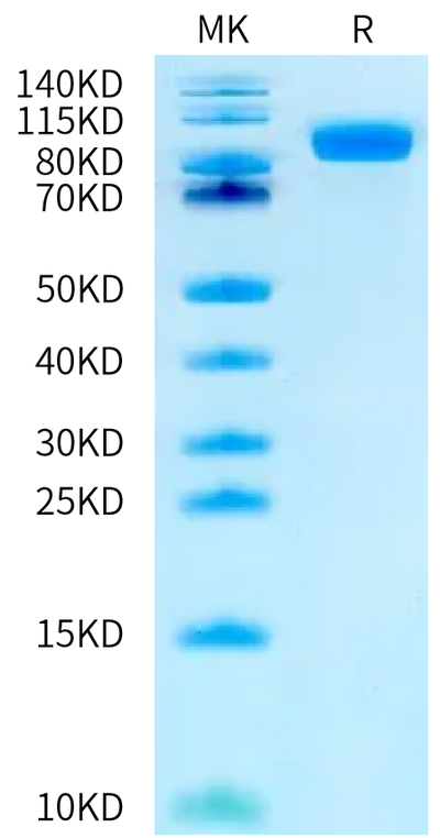 Human Her2 (S310F) on Bis-Tris PAGE under reduced condition. The purity is greater than 95%.Recombinant Human Her2/ErbB2 (S310F) Protein, Endotoxin-Free, Active