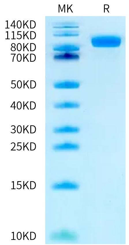 Human Her2 (S310F) on Bis-Tris PAGE under reduced condition. The purity is greater than 95%.Recombinant Human Her2/ErbB2 (S310F) Protein, Endotoxin-Free, Active