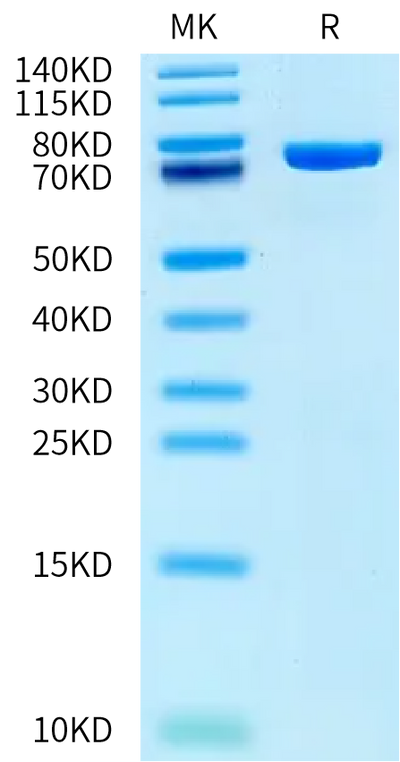 Rat DPP3 on Bis-Tris PAGE under reduced condition. The purity is greater than 95%.Recombinant Rat DPP3 Protein