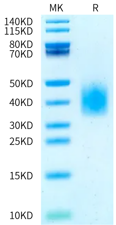 Human GCGR on Bis-Tris PAGE under reduced condition. The purity is greater than 95%.Recombinant Human GCGR/Glucagon receptor Protein