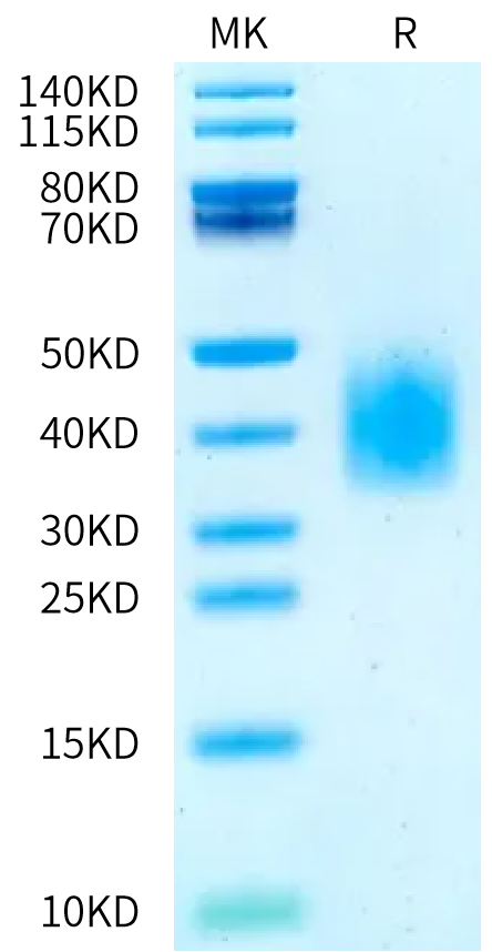Human GCGR on Bis-Tris PAGE under reduced condition. The purity is greater than 95%.Recombinant Human GCGR/Glucagon receptor Protein