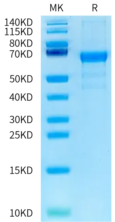 Human KIR2DL4 on Bis-Tris PAGE under reduced condition. The purity is greater than 90%.Recombinant Human KIR2DL4/CD158d Protein, Active