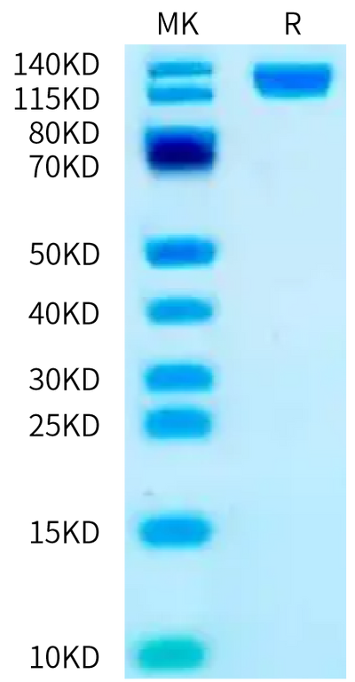 Biotinylated Human OSMR beta on Bis-Tris PAGE under reduced condition. The purity is greater than 95%.Biotinylated Human OSMR beta Protein, Active