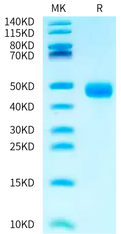 Biotinylated Human CD23 on Bis-Tris PAGE under reduced condition. The purity is greater than 95%.Biotinylated Human CD23/Fc epsilon RII Protein