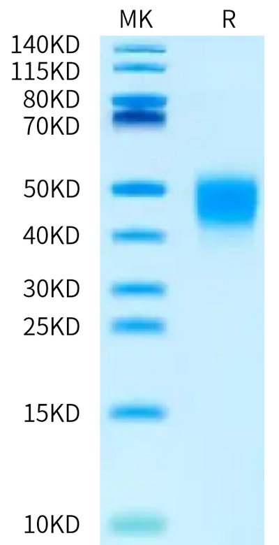 Biotinylated Human IFN alpha/beta R2 on Bis-Tris PAGE under reduced condition. The purity is greater than 95%.Biotinylated Human IFN alpha/beta R2 Protein, Active
